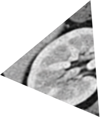 A triangle-shaped capture of a black-and-white scan.